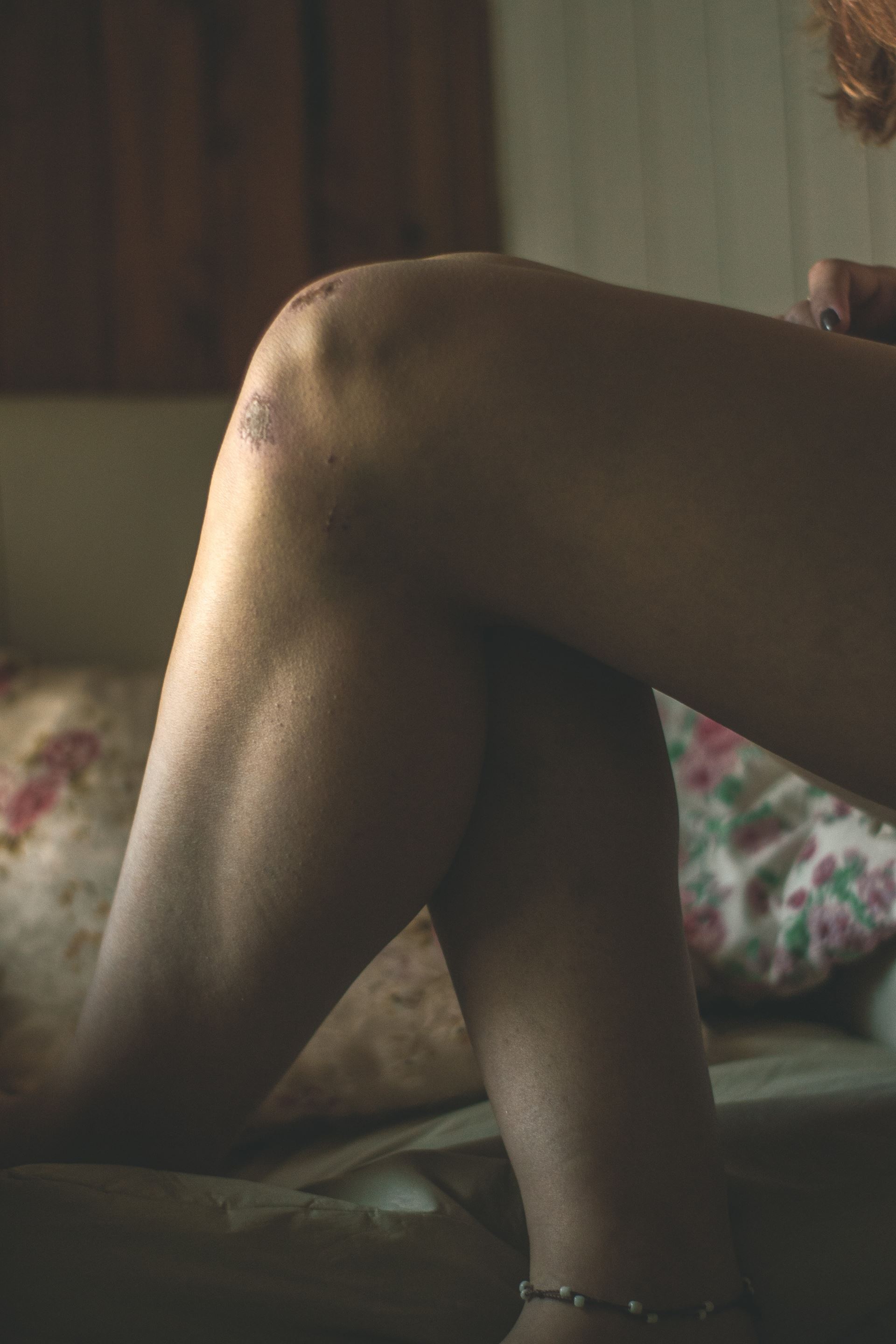 Knees