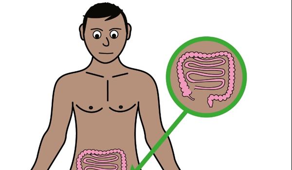 Cover picture for Bowel Screening easy read guide 